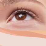 Cirurgia de Pálpebras