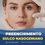 Preenchimento do sulco nasogeniano