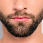 Transplante Bigode
